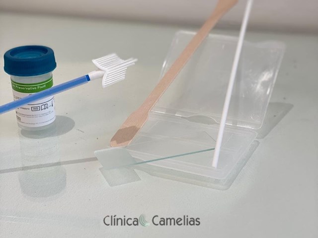 Citología convencional vs PCR de VPH: ¿En qué se diferencian y por qué es importante saberlo?