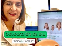 Colocación del DIU: qué es, cómo se coloca y qué control debes hacer. 