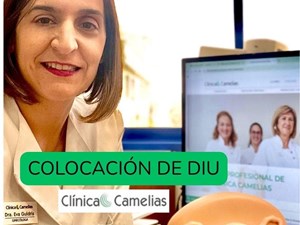 Colocación del DIU: qué es, cómo se coloca y qué control debes hacer. 