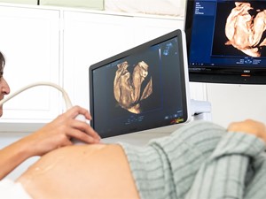 ¿Cuándo se puede saber el sexo del bebé?