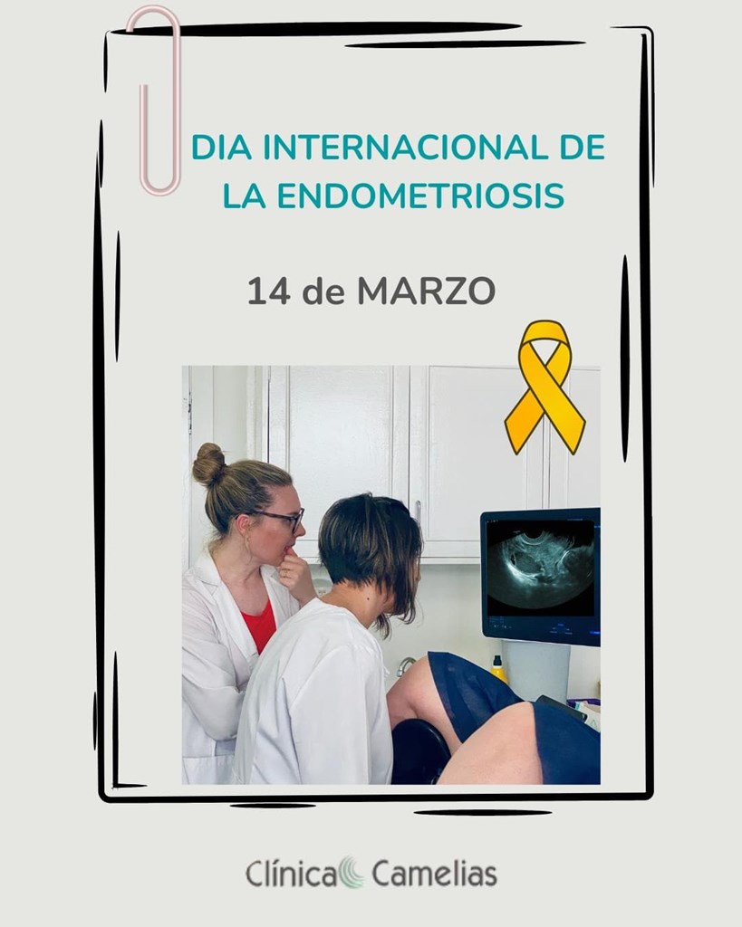  Diagnóstico de endometriosis en Vigo: cómo detectarla con ecografía ginecológica.