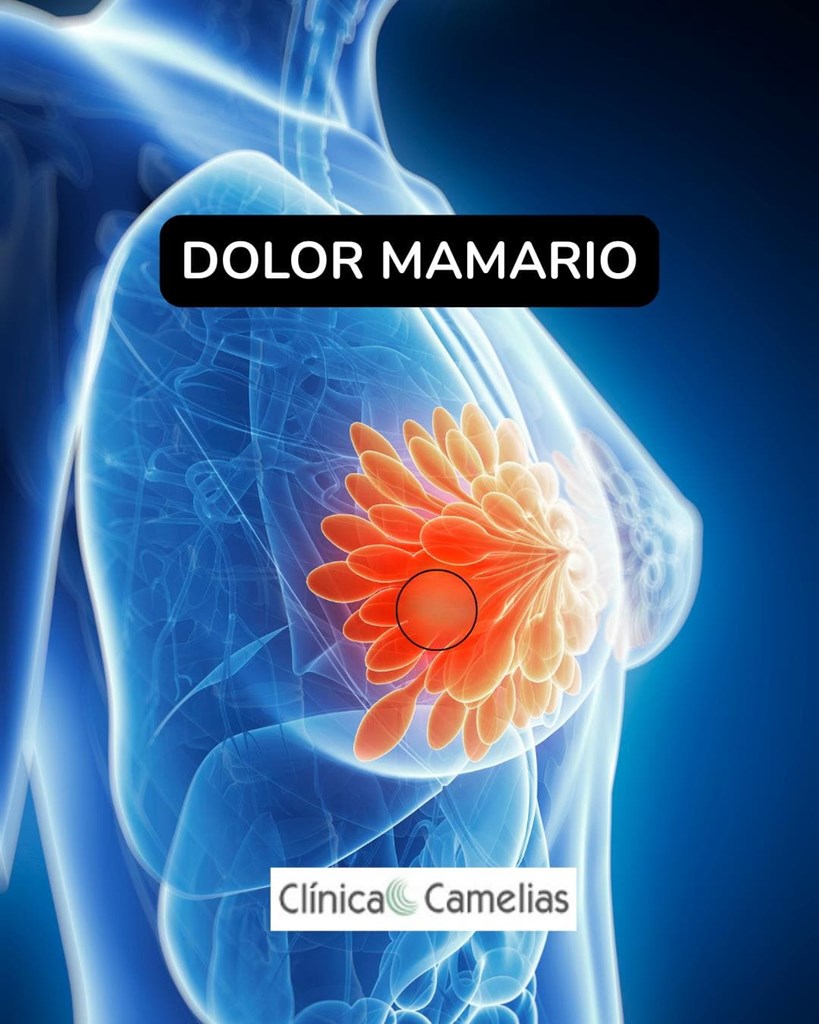 Dolor de mama: cuándo es normal y cuándo consultar. 