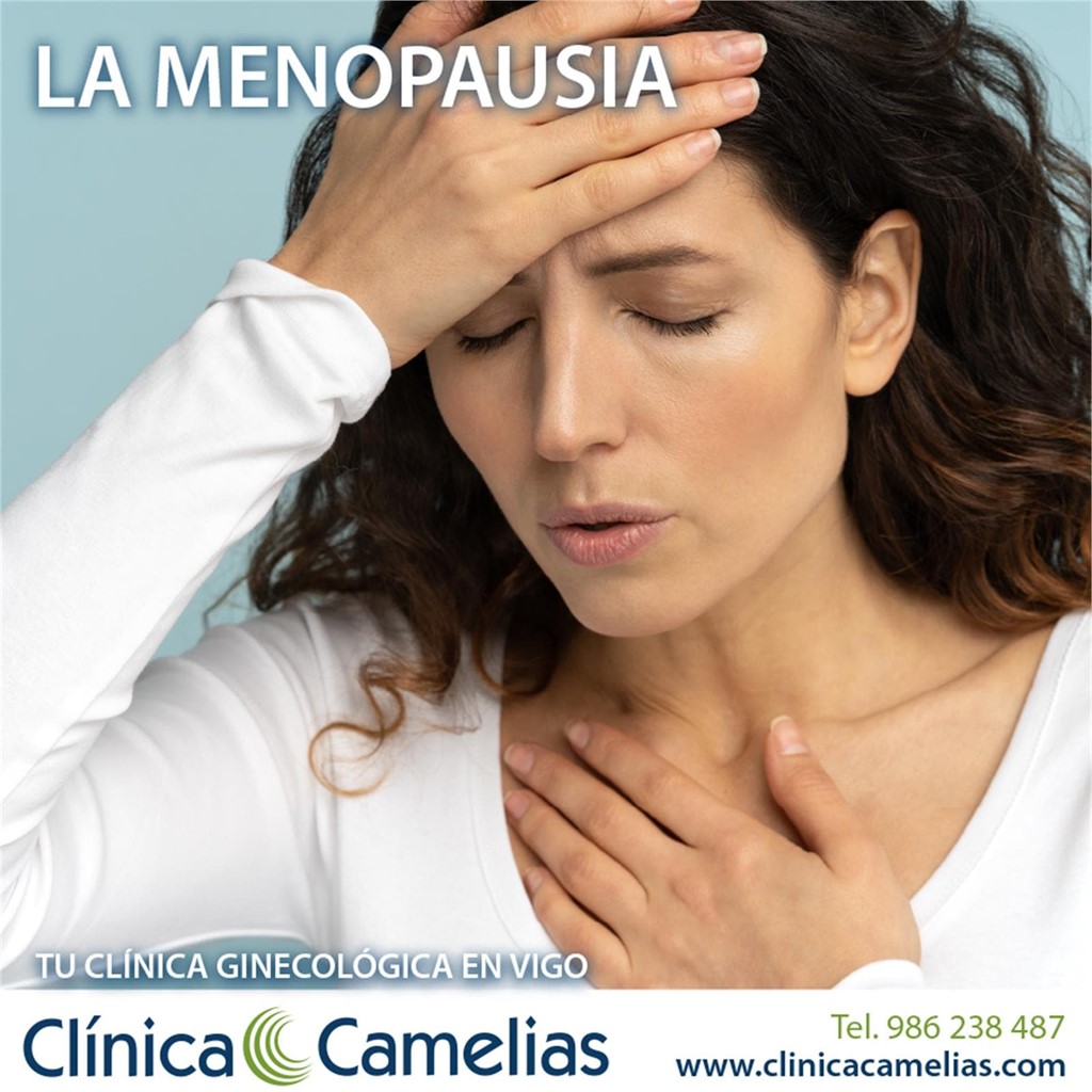 LA MENOPAUSIA