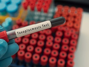 La toxoplasmosis, una infección común pero peligrosa para el feto