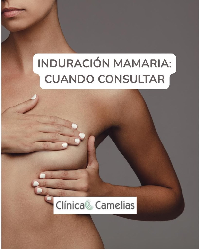  Zona más dura o indurada en la mama: un motivo frecuente de consulta.